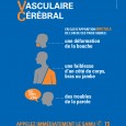 L’accident vasculaire cérébral (AVC), dit aussi « attaque cérébrale », est dû à une interruption brutale de l’irrigation sanguine d’une zone du cerveau (obstruction ou rupture d’une artère cérébrale). Les […]
